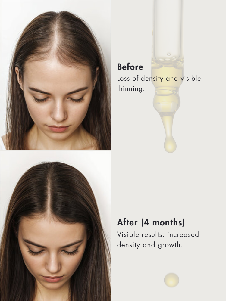 LUMIE | Hair Oil Treatment with Coconut & Rosemary for Growth